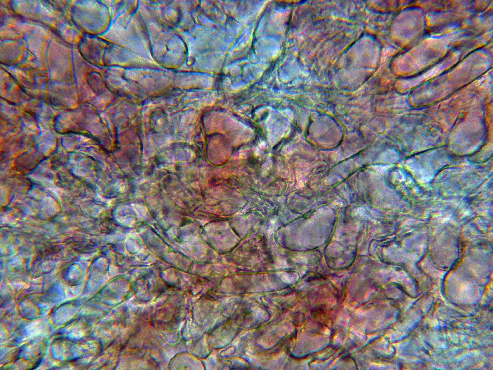 10 - Excípulo ectal-001